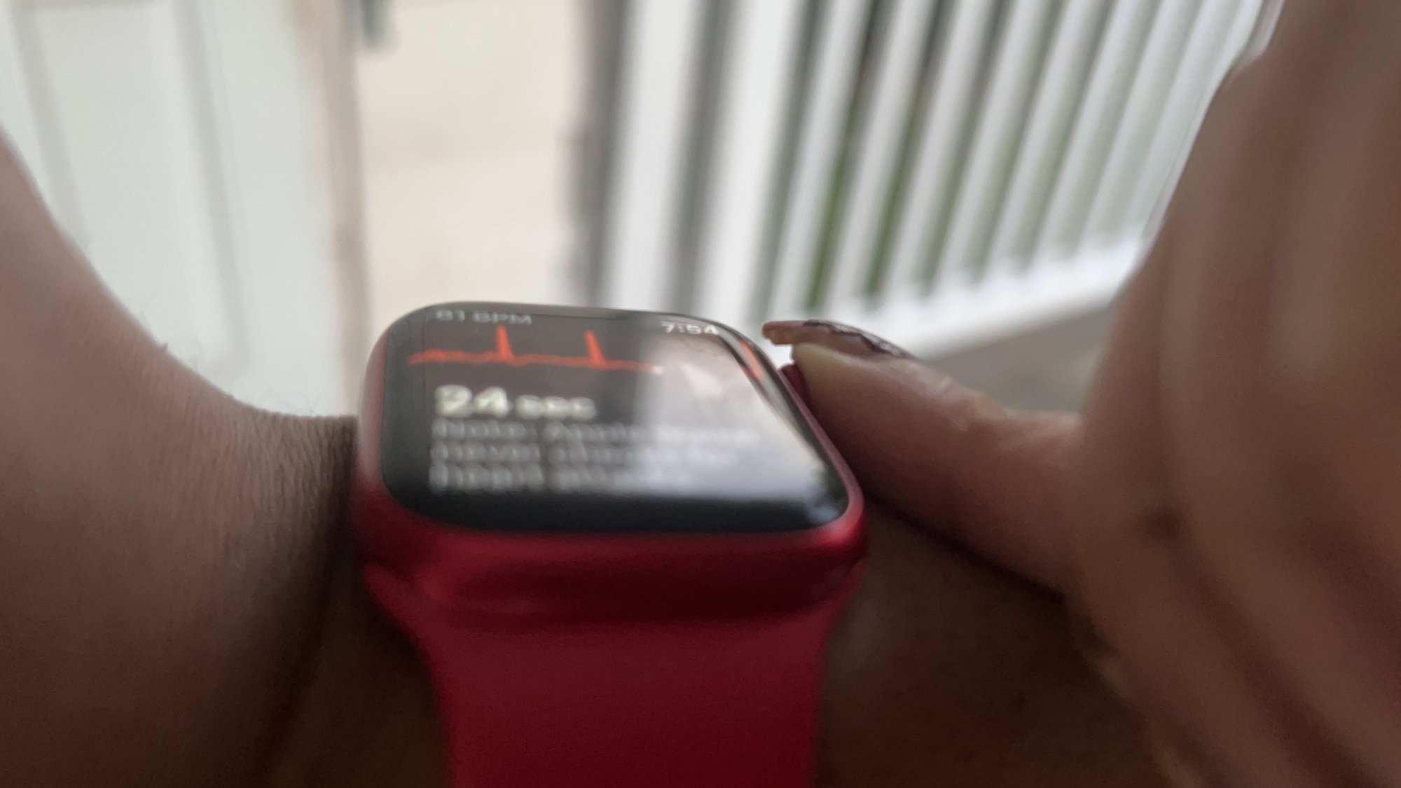 ECG on Apple Watch Series 9